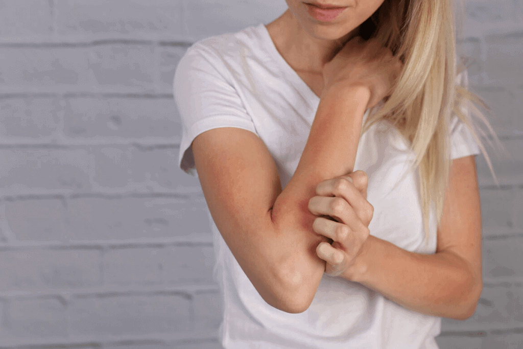 woman itching her arm