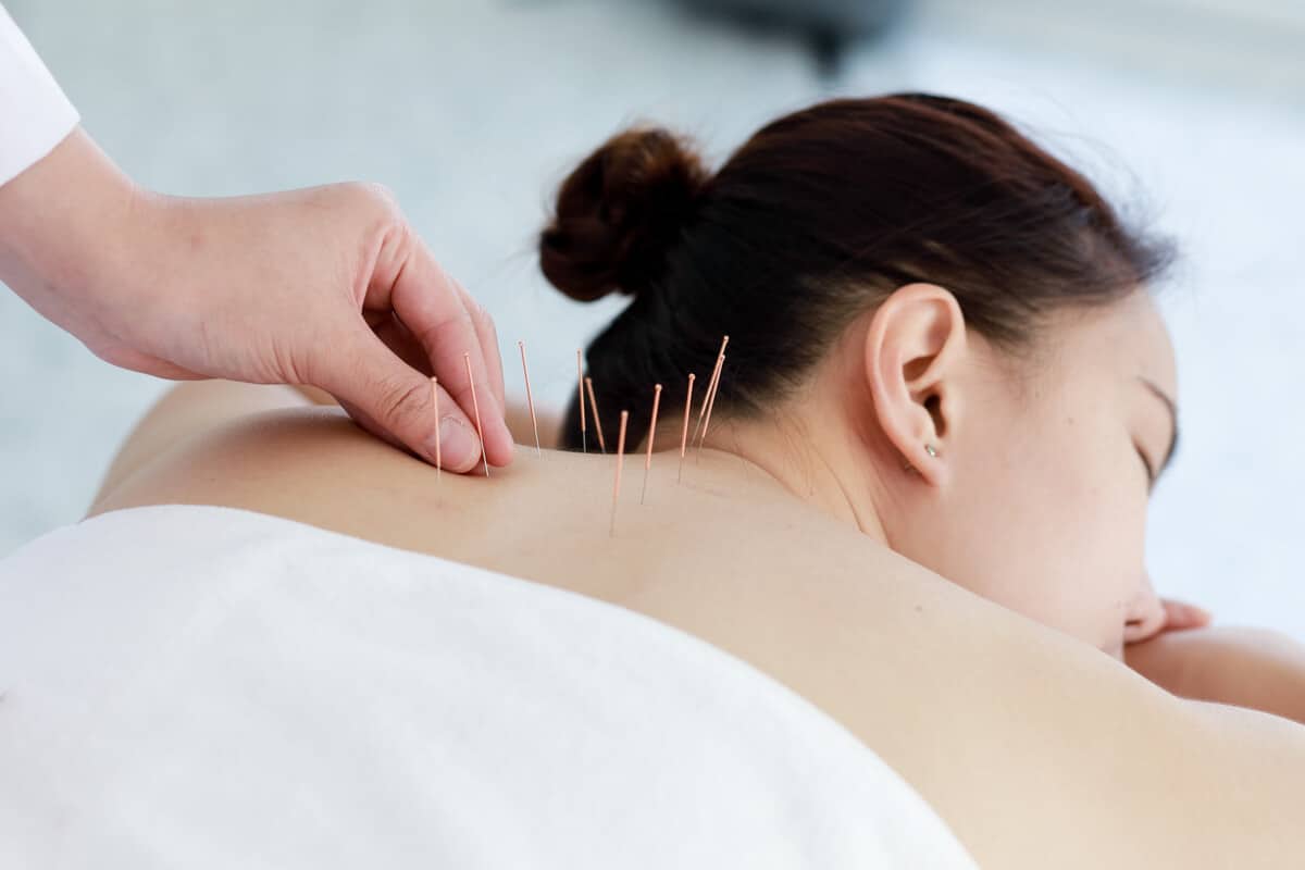 is integrative medicine legitimate woman receiving acupuncture