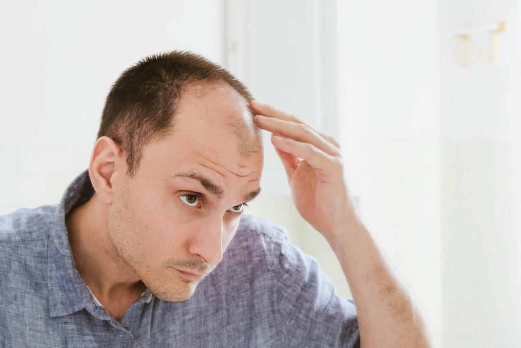 vitamin E oil may encourage hair growth in people with androgenic alopecia.