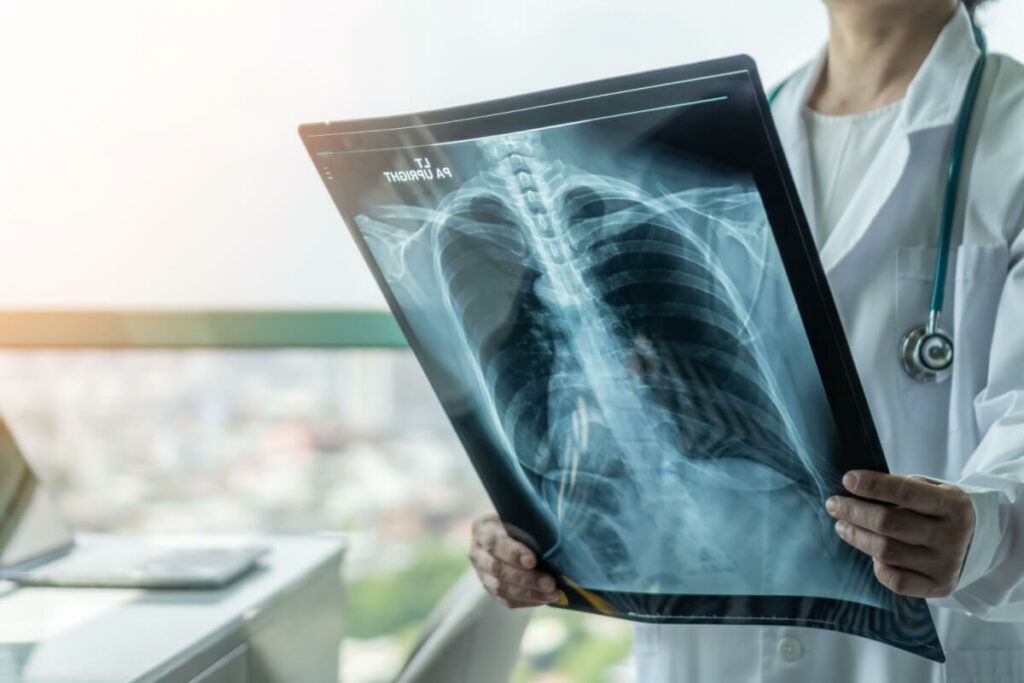 natural treatment for pneumonia cover image
