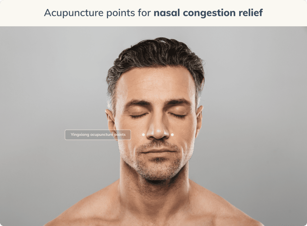 yingxiang acupuncture points diagram