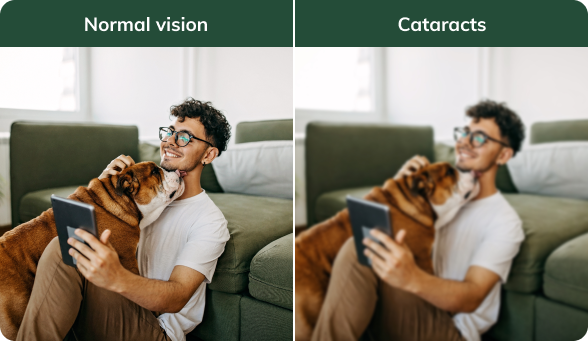 cataract diagram